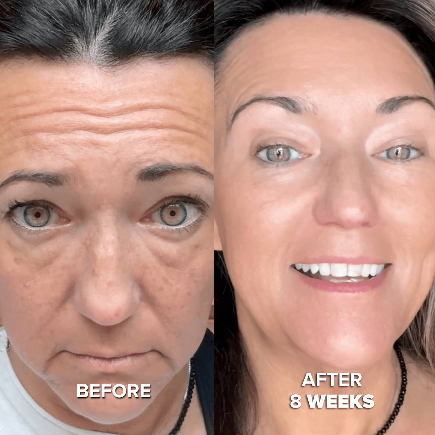 Collagen Mask