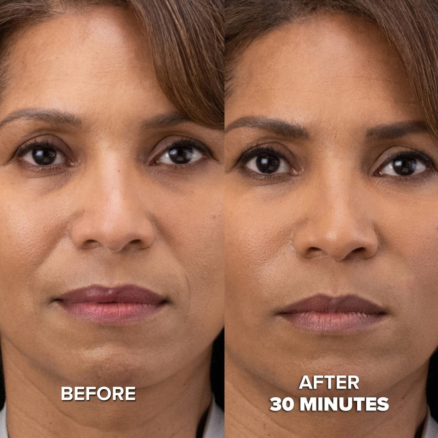 Collagen Mask